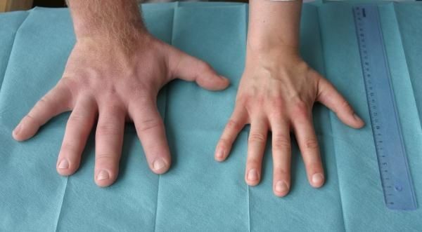 Autors: no neurochirurgie-tuebingen.de