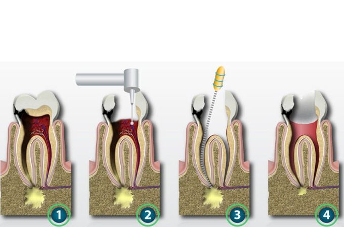 Autors: dentalcarematters.com