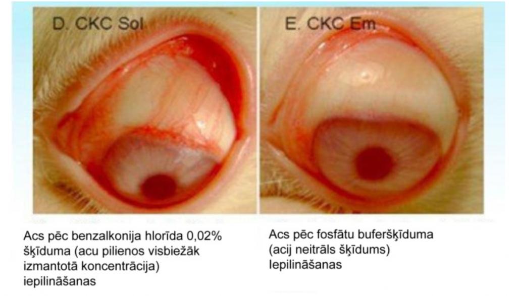 Abos gadījumos acis fotografētas 4 stundas pēc šķīduma iepilināšanas. Šķīduma turēšanas ilgums uz acs virsmas bija 15 minūtes